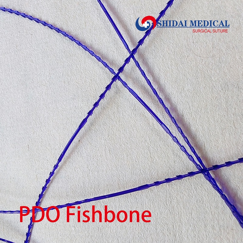 PDO Fishbone thread